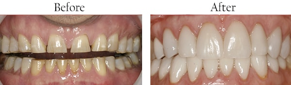 jamaica dental care